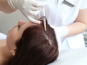 Mesotherapy For Hair Fall
