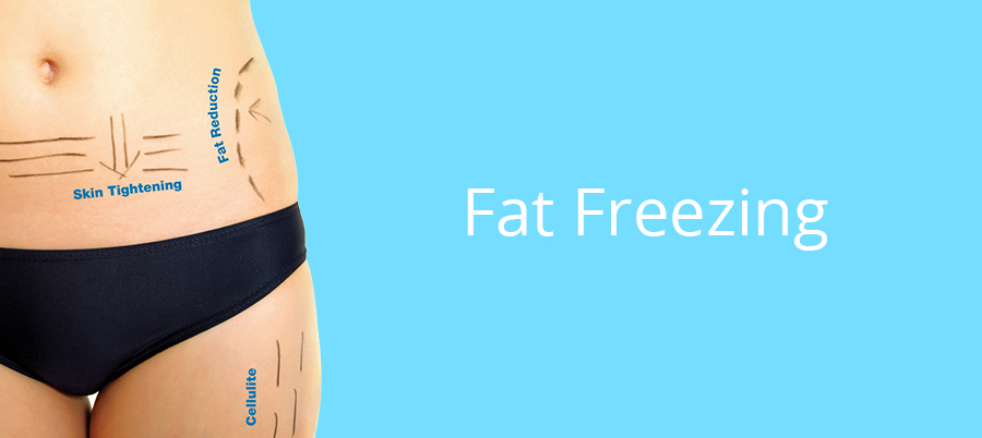 Your Guide To Fat Freezing (Cryolipolysis) in Dubai