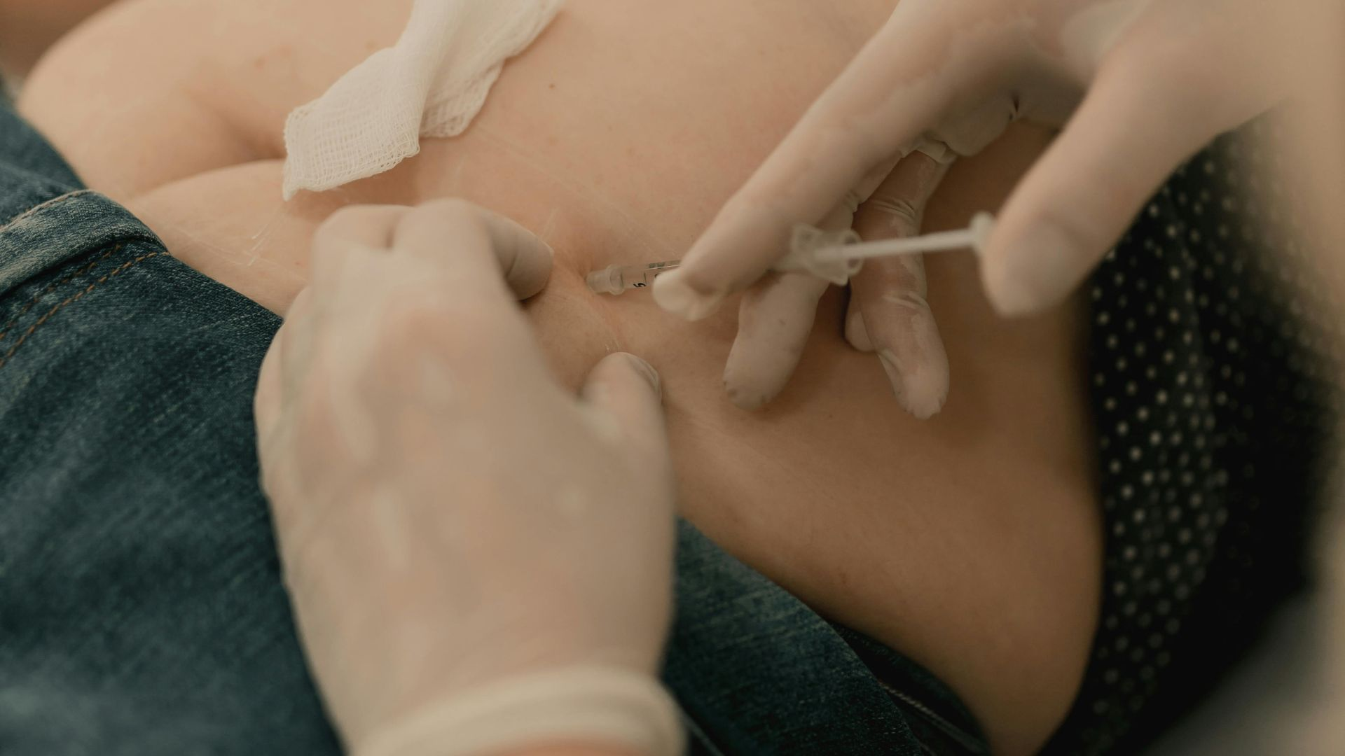 Lemon Bottle Injections